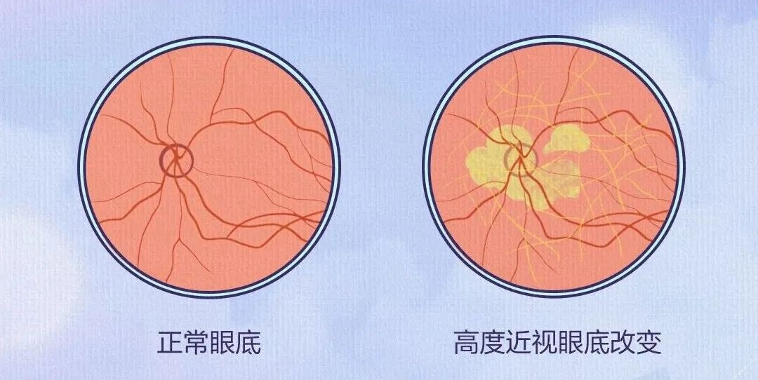 图片.png 图片.png